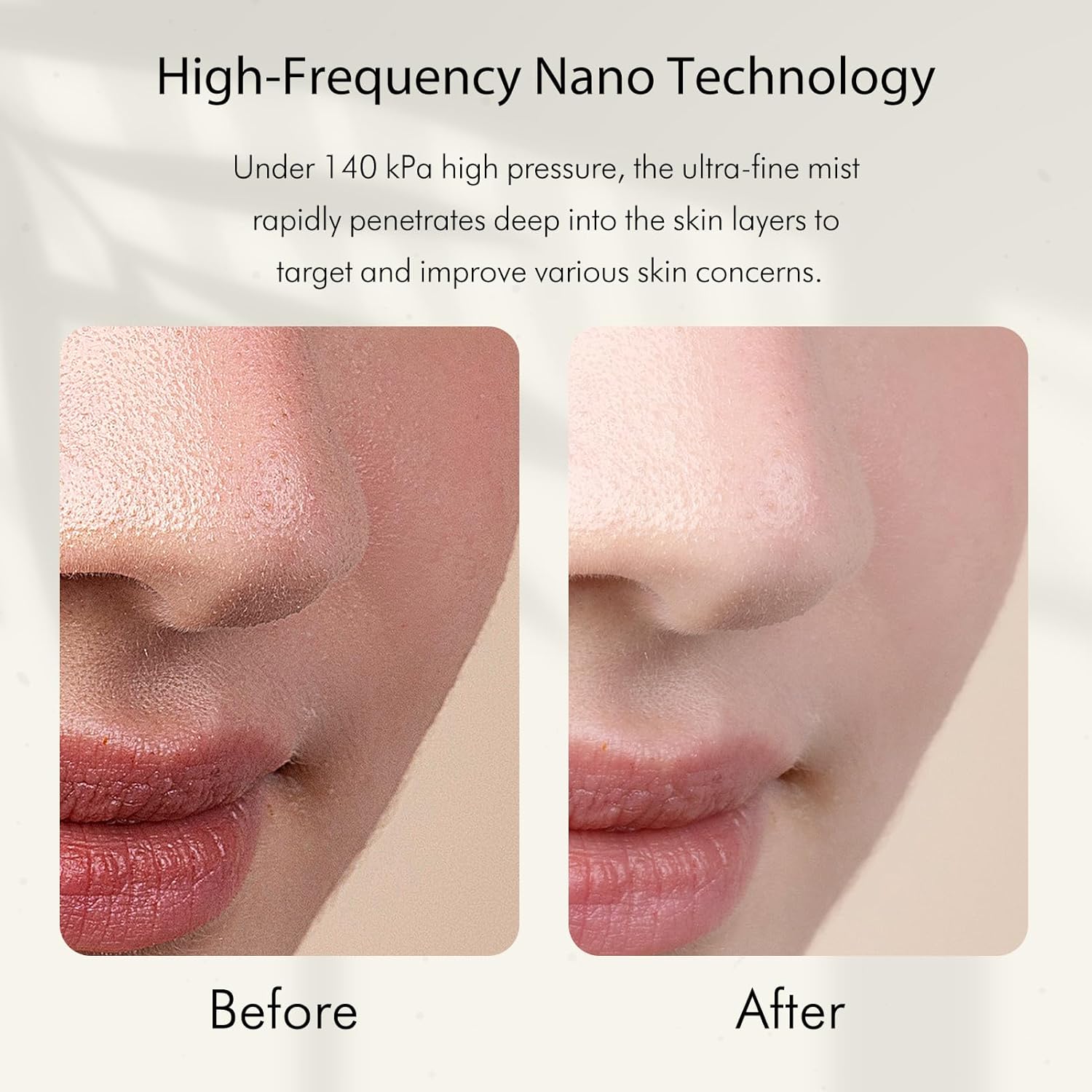 Nano-brumisateur ionique à fro - Face Steamer avis et prix